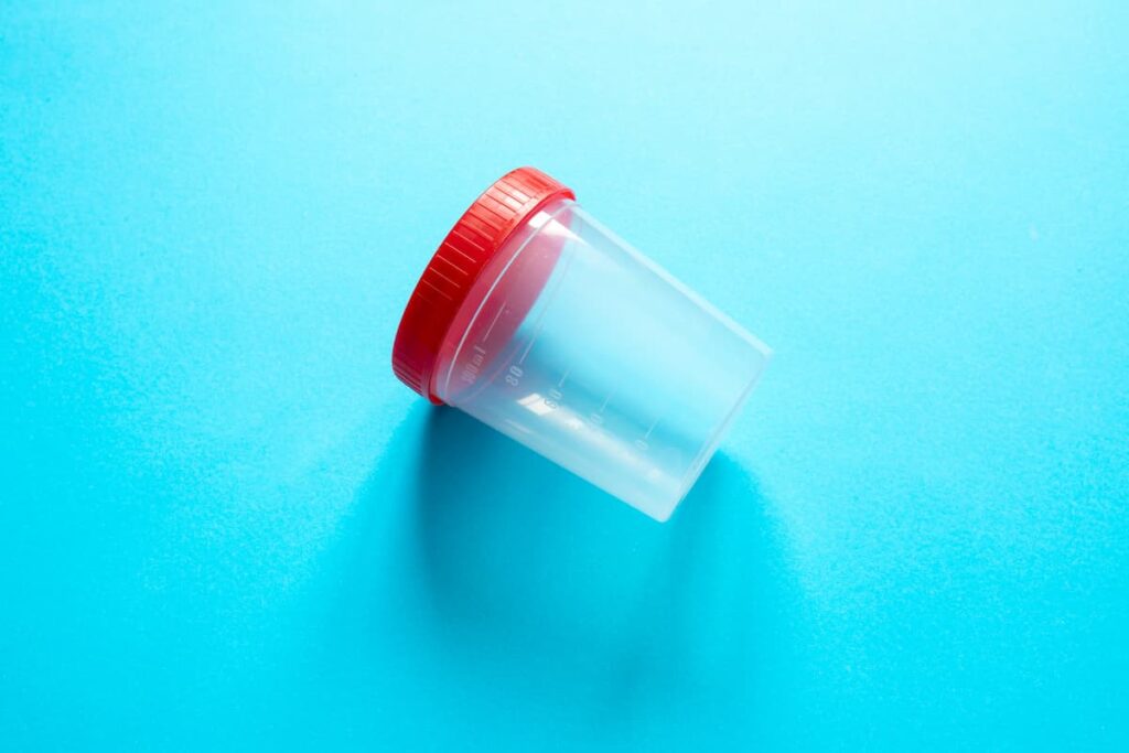 Photo of a drug test/urinalysis cup against a blue background